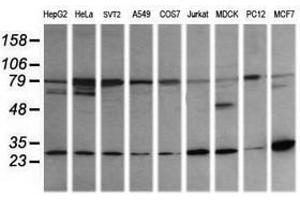 Image no. 4 for anti-RAB21, Member RAS Oncogene Family (RAB21) antibody (ABIN1500545) (RAB21 anticorps)