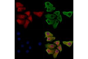 Phospho-SNAIL (Ser11) Antibody staining Hela cells(heat shock treatment) by IF/ICC. (SNAIL anticorps  (pSer11))