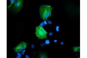 Anti-CCM2 mouse monoclonal antibody (ABIN2454939) immunofluorescent staining of COS7 cells transiently transfected by pCMV6-ENTRY CCM2 (RC201418). (CCM2 anticorps)