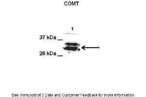 Lanes:   1. (COMT anticorps  (Middle Region))