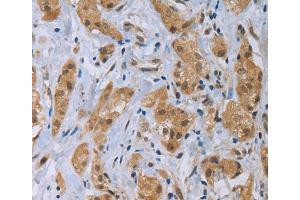 Immunohistochemistry (IHC) image for anti-C-Type Lectin Domain Family 1, Member A (CLEC1A) antibody (ABIN2427969) (CLEC1A anticorps)