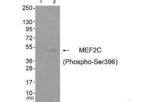 Western blot analysis of extracts from cos-7 cells (Lane 2), using MEF2C (Phospho-Ser396) Antibody. (MEF2C anticorps  (pSer396))