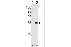 Western blot analysis of CK1G (arrow) using rabbit polyclonal CK1G (Center ) Antibody (ABIN391377 and ABIN2841388). (CAMK1G anticorps  (AA 211-241))