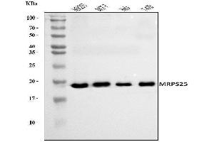 Western blot analysis of MRPS25 using anti-MRPS25 antibody (ABIN7599032).