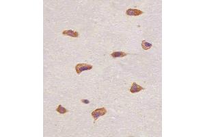 (ABIN6243222 and ABIN6577089) staining FGFR1 in human brain tissue sections by Immunohistochemistry (IHC-P - paraformaldehyde-fixed, paraffin-embedded sections). (FGFR1 anticorps  (C-Term))