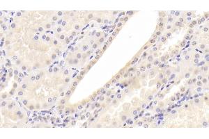 Detection of a2PI in Human Kidney Tissue using Monoclonal Antibody to Alpha 2-Antiplasmin (a2PI) (a2PI anticorps)