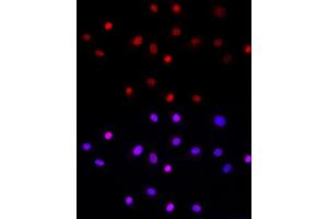Immunofluorescence analysis of NIH/3T3 cells using LEO1 Rabbit pAb (ABIN6133790, ABIN6143141 and ABIN7101832) at dilution of 1:50 (40x lens).