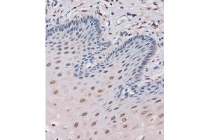Immunohistochemistry of paraffin-embedded Human esophageal using MTMR8 Rabbit pAb (ABIN7268766) at dilution of 1:100 (40x lens).