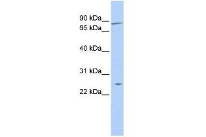 WB Suggested Anti-ZNF613 Antibody Titration:  0. (ZNF613 anticorps  (N-Term))