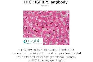 Image no. 1 for anti-Insulin-Like Growth Factor Binding Protein 5 (IGFBP5) (AA 192-206) antibody (ABIN1735787) (IGFBP5 anticorps  (AA 192-206))