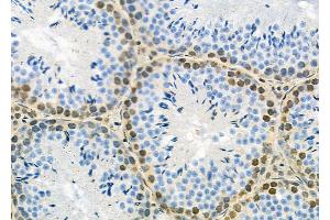 ABIN6263195 and ABIN6279528 at 1/100 staining Rat brain tissue by IHC-P.