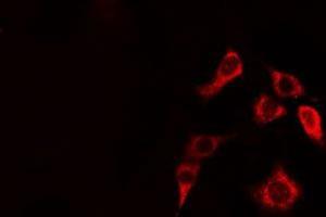 ABIN6274948 staining HepG2 cells by IF/ICC. (CLIP2 anticorps  (C-Term))