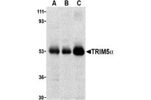 Image no. 2 for anti-Tripartite Motif Containing 5 (TRIM5) (C-Term) antibody (ABIN203830) (TRIM5 anticorps  (C-Term))