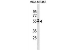 Western Blotting (WB) image for anti-T Antigen antibody (ABIN3001361) (T Antigen anticorps)