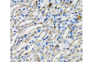 Immunohistochemistry of paraffin-embedded Mouse kidney using COPB2 Polyclonal Antibody at dilution of 1:100 (40x lens).