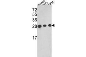 Western blot analysis of TPI1 Antibody (TPI1 anticorps  (C-Term))