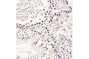 Immunohistochemistry of paraffin embedded mouse testis using sav1 (ABIN7075505) at dilution of 1:200 (400x lens) (SAV1 anticorps)
