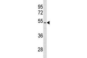 PTEN antibody western blot analysis in NCI-H460 lysate.