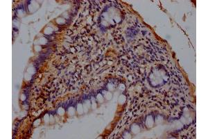 IHC image of ABIN7148200 diluted at 1:140 and staining in paraffin-embedded human small intestine tissue performed on a Leica BondTM system.