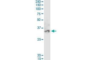 CA3 MaxPab rabbit polyclonal antibody. (CA3 anticorps  (AA 1-260))
