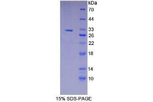 SDS-PAGE analysis of Human gSAP Protein. (GSAP Protéine)