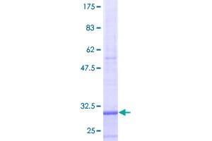 Image no. 1 for Suppression of Tumorigenicity 13 (ST13) (AA 1-58) protein (GST tag) (ABIN1321468)