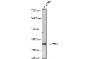 Western blot analysis of extracts of U-87MG cells using GPM6A Polyclonal Antibody at dilution of 1:1000. (GPM6A anticorps)
