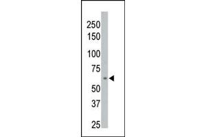 The anti-M1D Pab (ABIN392853 and ABIN2842271) is used in Western blot to detect M1D in 293 cell lysate.