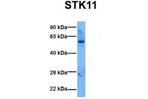 Host:  Rabbit  Target Name:  STK11  Sample Tissue:  Human 293T  Antibody Dilution:  1. (LKB1 anticorps  (N-Term))