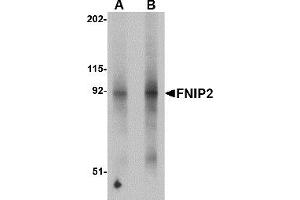 Western Blotting (WB) image for anti-Folliculin Interacting Protein 2 (FNIP2) (N-Term) antibody (ABIN1031382)