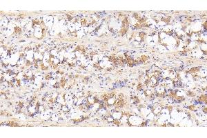 anti-Interleukin 17 Receptor D (IL17RD) (AA 157-299) antibody