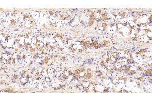 Detection of IL17RD in Human Stomach Tissue using Polyclonal Antibody to Interleukin 17 Receptor D (IL17RD) (IL17RD anticorps  (AA 157-299))