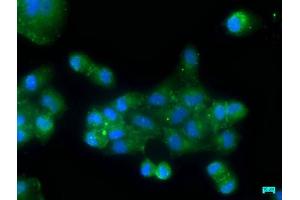 Immunofluorescence staining of Hela cells with ABIN7162407 at 1:50, counter-stained with DAPI. (OSBPL7 anticorps  (AA 1-249))