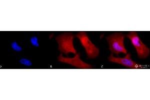 Immunocytochemistry/Immunofluorescence analysis using Rabbit Anti-Phosphotyrosine Polyclonal Antibody .