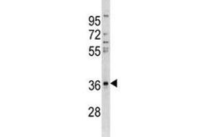 Anti-CTGF antibody western blot analysis in A549 lysate