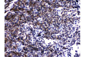 Anti- Lck Picoband antibody, IHC(P) IHC(P): Mouse Lymphaden Tissue