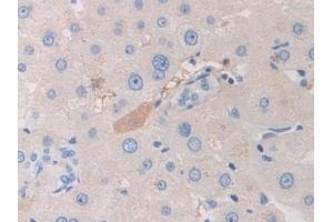 Detection of PZP in Human Liver Tissue using Polyclonal Antibody to Pregnancy Zone Protein (PZP)