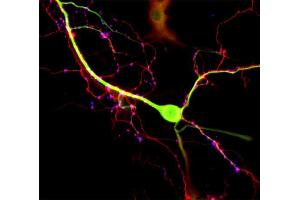 Immunofluorescence labeling of cultured hippocampus neurons (DIV 14) with anti-MAP 2, specific for dendrites (dilution 1 : 1000, green)and guinea-pig anti-Tau, specific for axons (Cat.