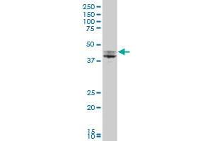 USP12 polyclonal antibody (A01), Lot # 051115JC01 Western Blot analysis of USP12 expression in MCF-7 .