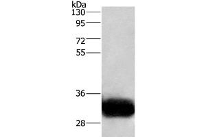 Western Blot analysis of Human fetal brain tissue using GPM6A Polyclonal Antibody at dilution of 1:950 (GPM6A anticorps)