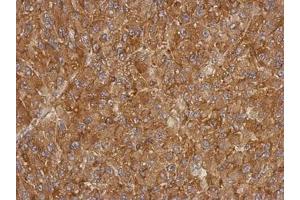 Image no. 1 for anti-Actin-Related Protein T1 (ACTRT1) (AA 174-376) antibody (ABIN1496449)