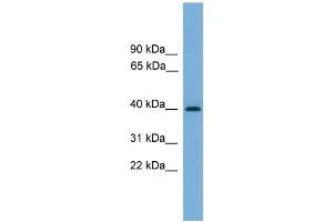 WB Suggested Anti-SERPINB8 Antibody Titration: 0.