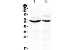 Western blot analysis of KPNA2 using anti-KPNA2 antibody . (KPNA2 anticorps  (N-Term))
