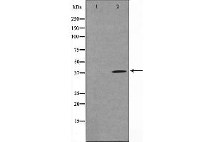Western blot analysis on COLO205 cell lysate using TUSC3 Antibody,The lane on the left is treated with the antigen-specific peptide. (TUSC3 anticorps  (Internal Region))