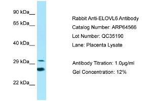 Western Blotting (WB) image for anti-ELOVL Fatty Acid Elongase 6 (ELOVL6) (N-Term) antibody (ABIN2789880) (ELOVL6 anticorps  (N-Term))