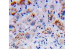 Used in DAB staining on fromalin fixed paraffin-embedded Liver tissue