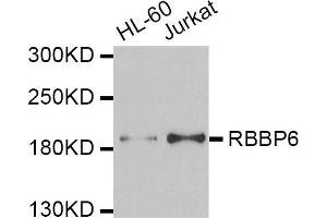 Western blot analysis of extracts of HL60 and Jurkat cell lines, using RBBP6 antibody. (RBBP6 anticorps)