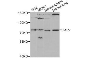 Western blot analysis of extracts of various cell lines, using TAP2 antibody. (TAP2 anticorps)