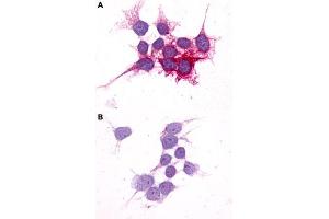 Immunocytochemistry (ICC) staining of HEK293 human embryonic kidney cells transfected (A) or untransfected (B) with P2RY14. (P2RY14 anticorps  (C-Term))