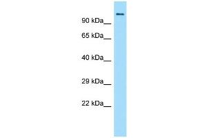 Host:  Rabbit  Target Name:  Brd4  Sample Type:  Rat Small Intestine lysates  Antibody Dilution:  1. (BRD4 anticorps  (N-Term))